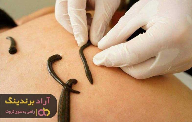 قیمت زالوی آب شیرین طبی در اصفهان 1 قیمت زالوی آب شیرین طبی در اصفهان