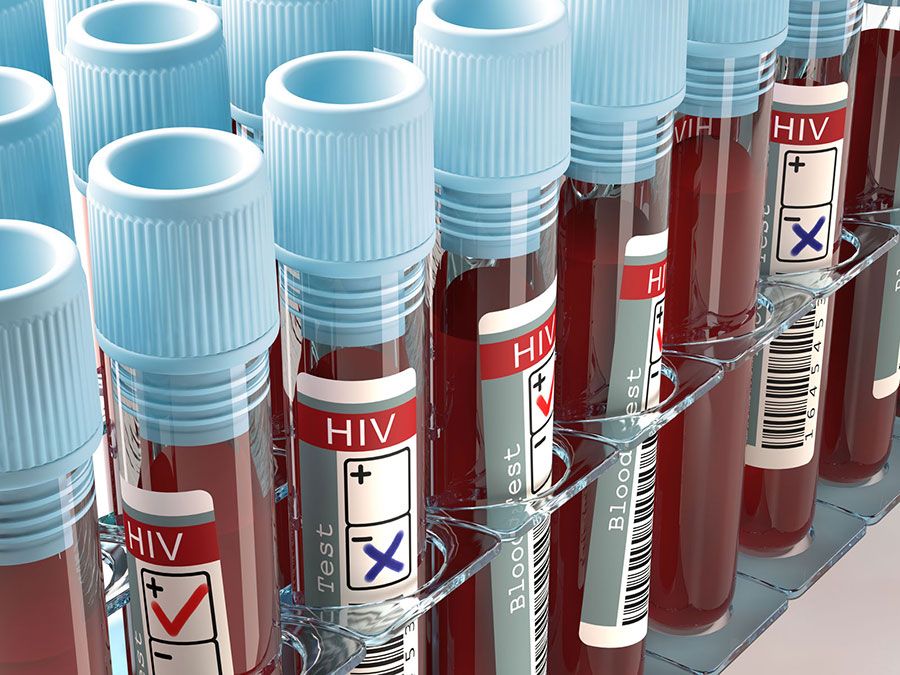 هر دقیقه یک قربانی جدید ایدز؛ آیا برنامه جهانی، HIV را تا ۲۰۳۰ مهار می‌کند؟