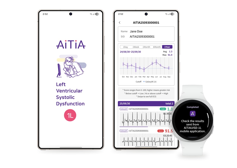 تشخیص زودهنگام نارسایی قلبی و ارتقای سلامت روان با فناوریهای پوشیدنی سامسونگ 1 فناوریهای پوشیدنی سامسونگ