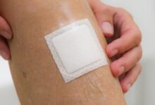 پانسمان چسبنده روی زخم در بازوی فرد